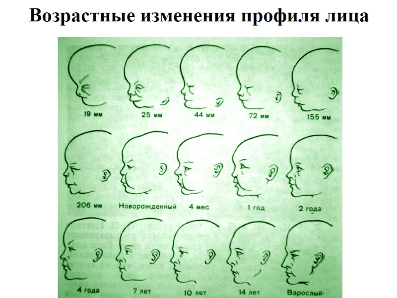 Возрастные изменения профиля лица
